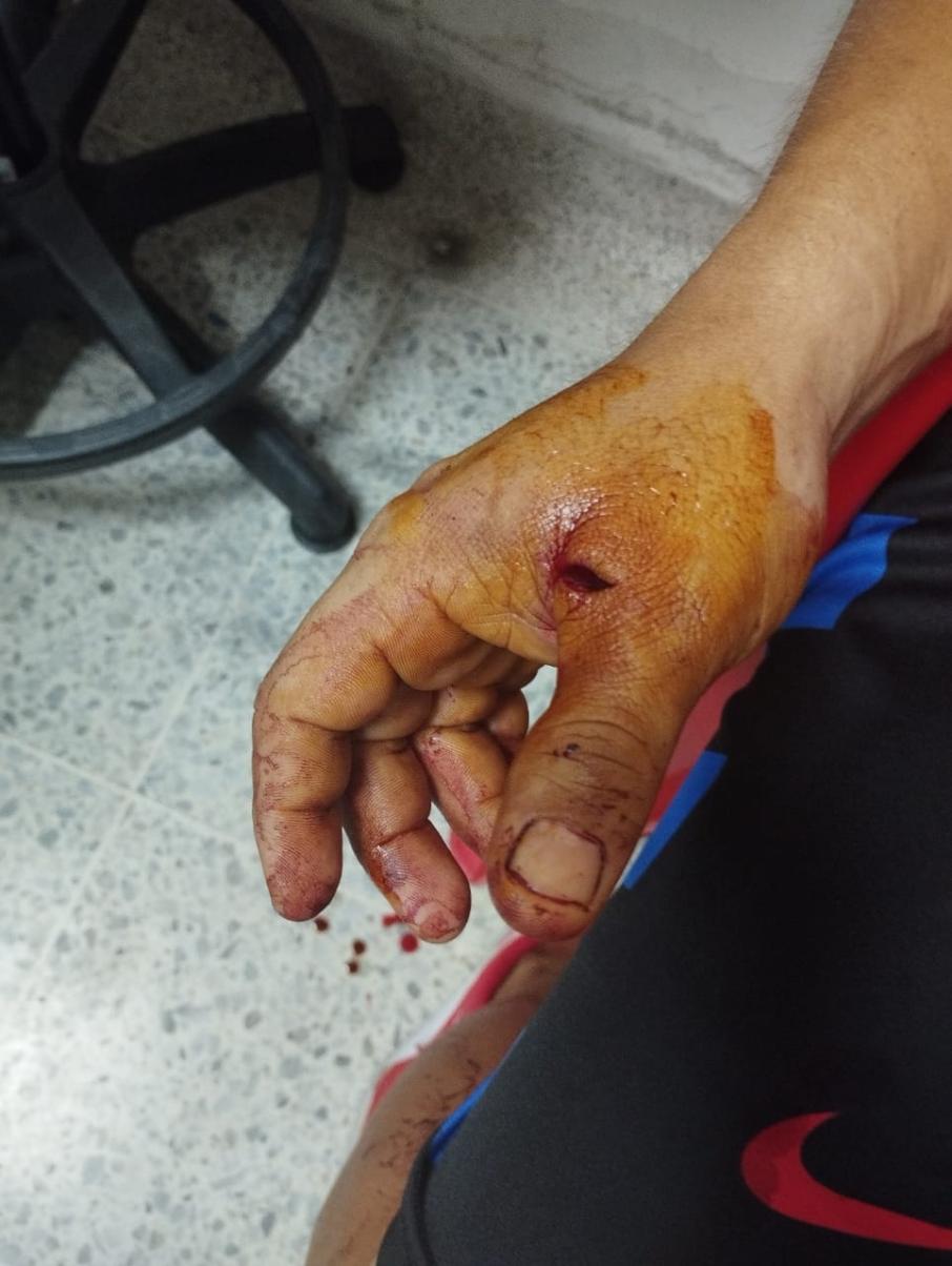 Mano Ataque